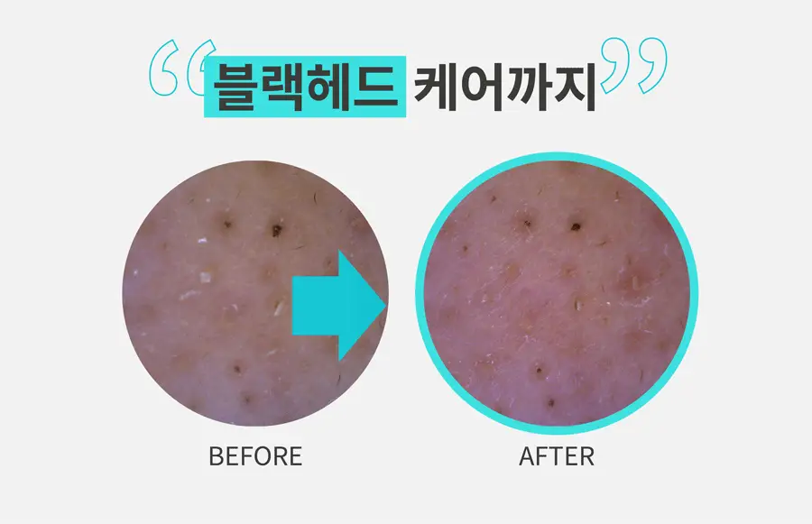 [1+1/모든 원료 비건] 포인트앤 딥 클린 휩 클렌징 폼 120g 1+1 기획 상세페이지 11
